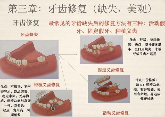 没有人告诉你的内幕，关于种植牙最大的4个危害 