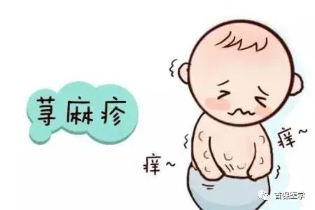 荨麻疹、湿疹与带状疱疹你能区分开吗？ 