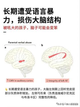 2.024新澳澳资料免费大全，拓展解答解释落实：长期遭受语言暴力，损伤大脑结构被吼大的孩子，脑子可能会变笨。  