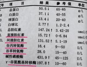 查出转氨酶高怎么办？高到多少才算肝炎？教你看2个数值初步判断 