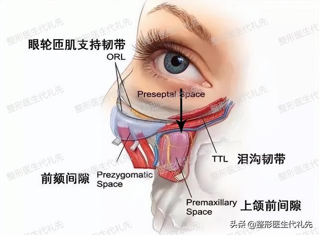 40~60岁眼袋手术担心有外翻、术后疤痕，肿胀，真人案例来看细节 