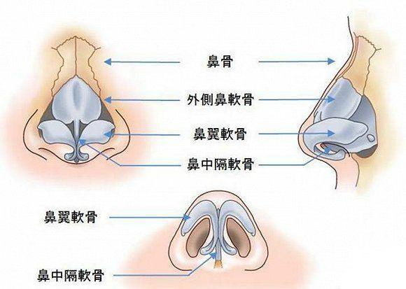 鼻头缩小手术怎么做？鼻头缩小术会反弹吗? 