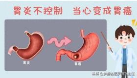 如何区分胃炎和胃癌，有好办法吗? 