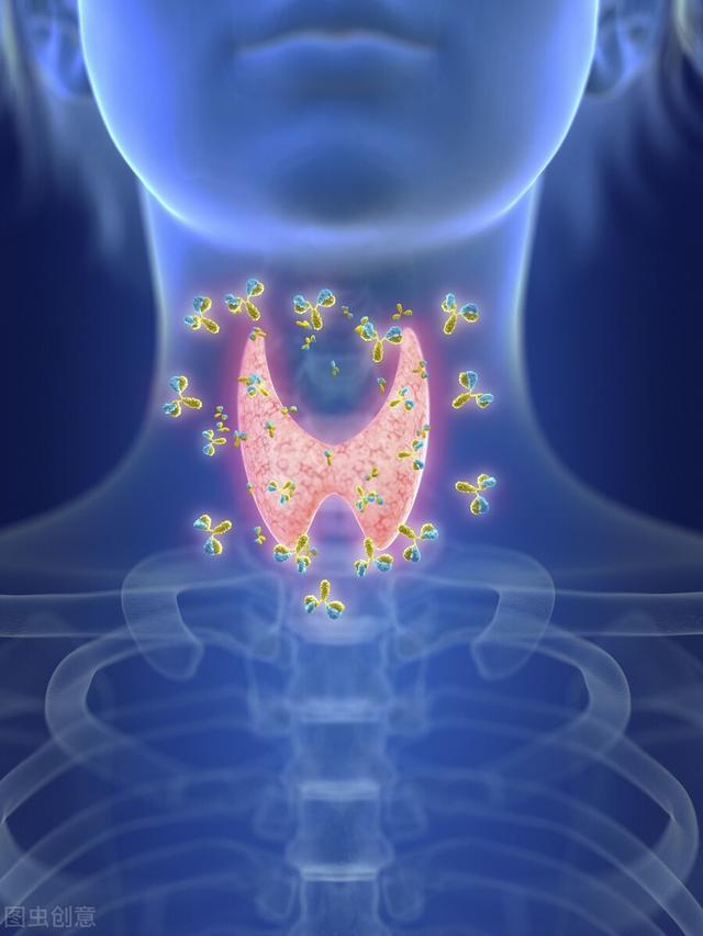 甲亢的三种治疗方式您都知道吗？ 