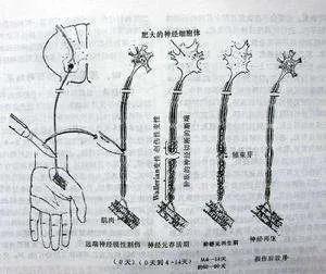 神经损伤后能再生吗？神经是怎样修复的？ 