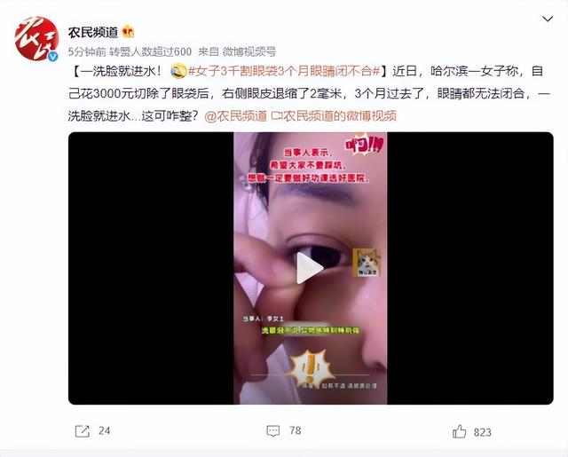 女子花3千元割眼袋，后遗症很严重。 