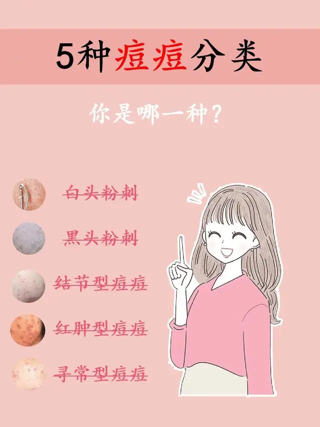 5种不同类型得痘痘 