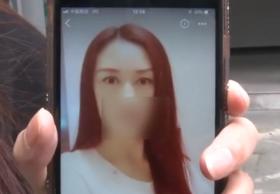 女子花25000元割双眼皮，本想美丽回到家乡，可术后不敢见人了... 