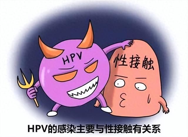 女性感染hpv初期症状有哪些？ 