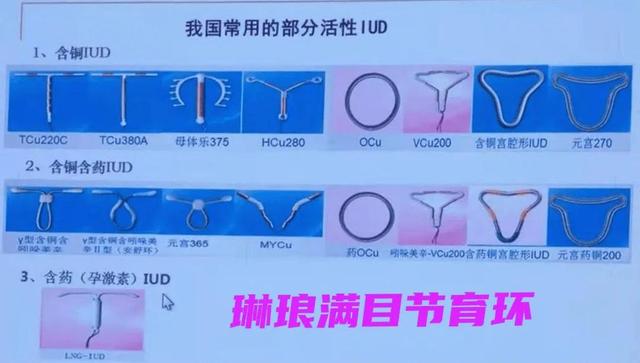 琳琅满目的节育环总有一款适合你 