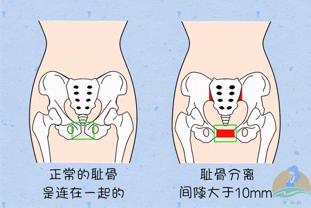 你真的把钙补够了吗？孕期每日钙需求参考量，附补钙食物排行榜 