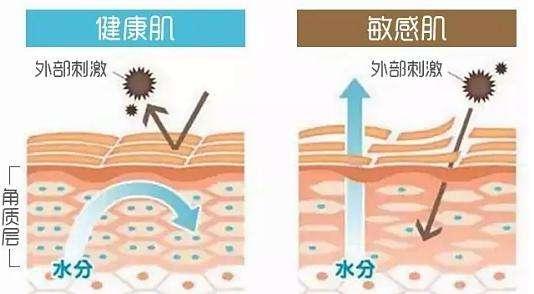 如何科学有效的治疗红血丝? 