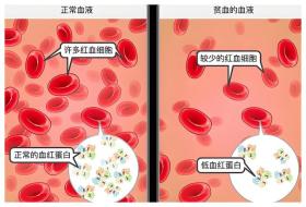 溶血性贫血的病理原因及治疗是什么？ 